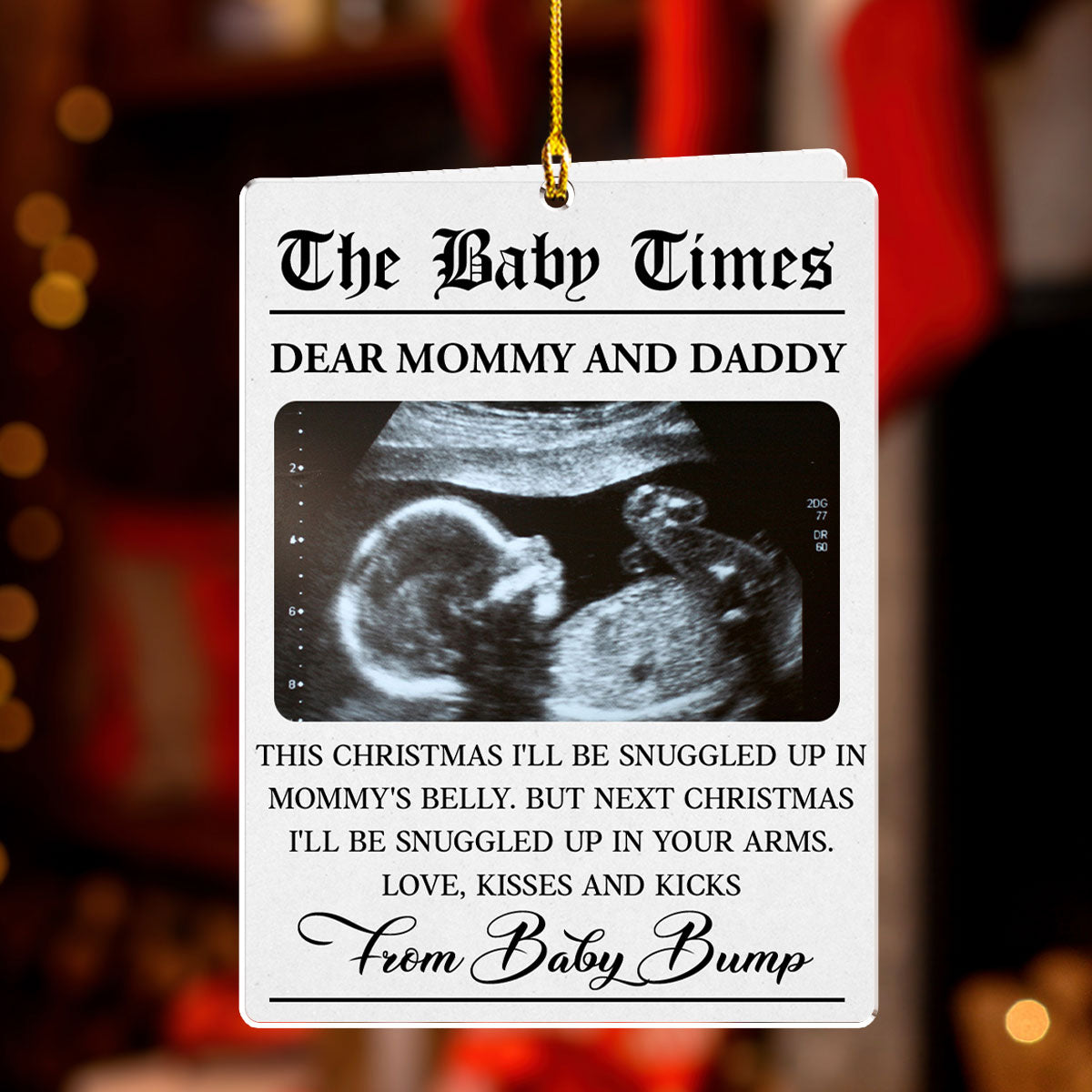 The Baby Times - Personalized Custom Acrylic Ornament