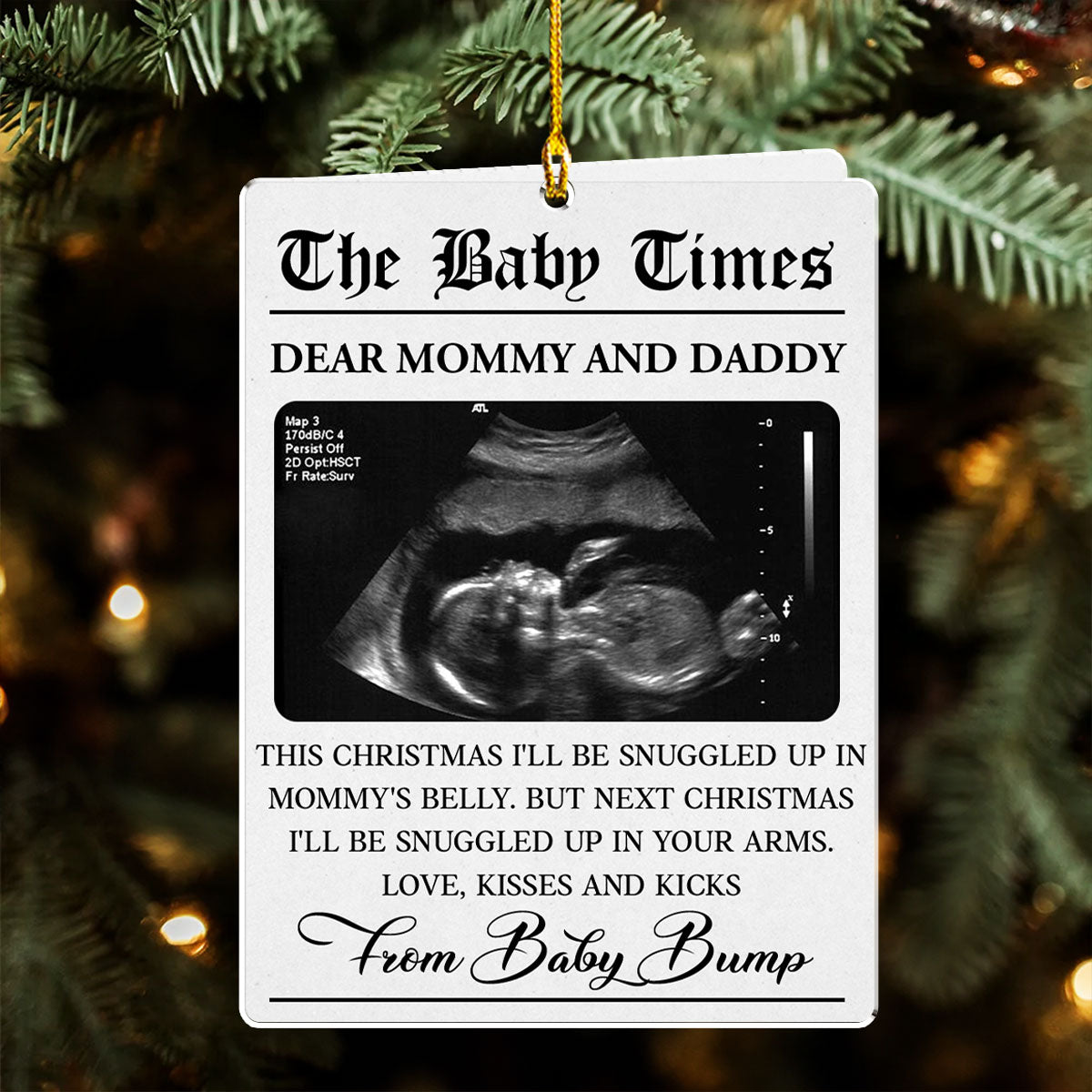 The Baby Times - Personalized Custom Acrylic Ornament